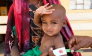 Halimo Hassan (1 year and 2 months) and mother Khayro Ali Hassan (30) in a remote health centre in Filtu, Somali Region. Halimo is being treated for severe acute malnutrition with the support of International NGO Concern Worldwide. Photo: Jennifer Nolan/ Concern Worldwide