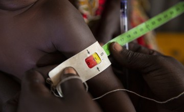 A child gets MUAC measurement assessed by a nutrition assistant at a Nutrition Centre in Gambella, Ethiopia.