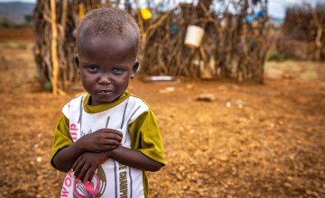 Erupe is malnourished as a result of drought in Kenya. 