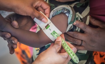 Awaale is 1 1/2 years old. He's one of the lucky children who has access to this local medical centre. Photo: Gavin Douglas