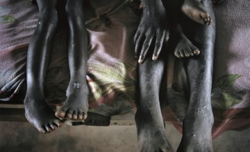 Octavie is only 13 but is responsible for her nephew after their mothers moved away to the city. Some days the children have nothing to eat and as a result Jolidor(aged two) is malnourished. He has been receiving a special therapeutic food for the last th