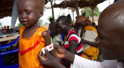 A malnourished child being treated at a primary care centre in South Sudan. 