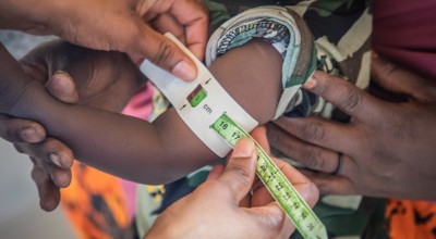 Awaale is 1 1/2 years old. He's one of the lucky children who has access to this local medical centre. Photo: Gavin Douglas